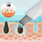 Ultrasonic Skin Scrubber Deep Cleaning
