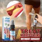 Veins Treatment Spray